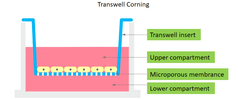 Tumor Cells Transwell Test