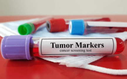 Cancer Biomarker Discovery